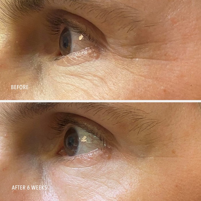 Close-up comparison of a person's eye area before and after 6 weeks of using Daily Drench | HydroPeptide, showing reduced wrinkles and smoother skin texture.