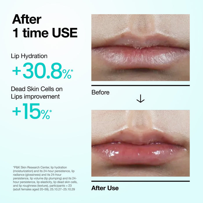 ANUA PDRN Lip Serum - DOKAN