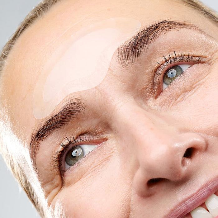 MICRONEEDLING_FORHEAD_MODEL