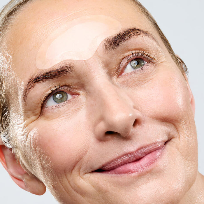MICRONEEDLING_FORHEAD_MODEL