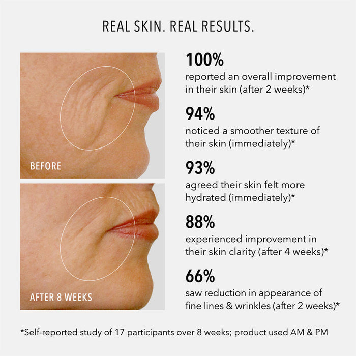 Before and after close-up images of a woman's lower face showing reduced fine lines and wrinkles after 8 weeks, highlighting results from using Daily Drench | HydroPeptide skincare product.