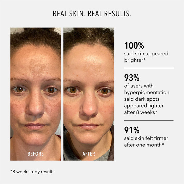 Before and after comparison of a woman's face showing improved skin brightness, reduced dark spots, and firmer skin using Firma-Bright | HydroPeptide skincare product over eight weeks