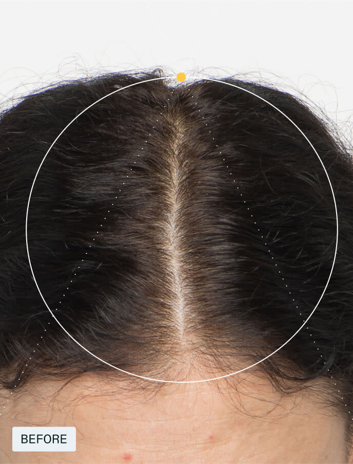 Nutrafol Women's Hair Growth System Supplement