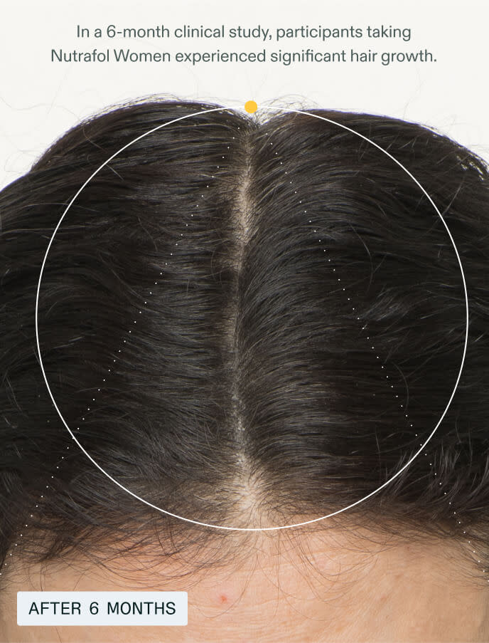 Nutrafol Women's Hair Growth System Supplement