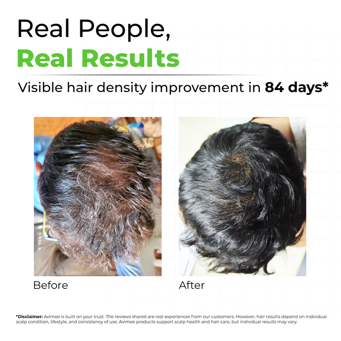 Rosemary Water for Hair
